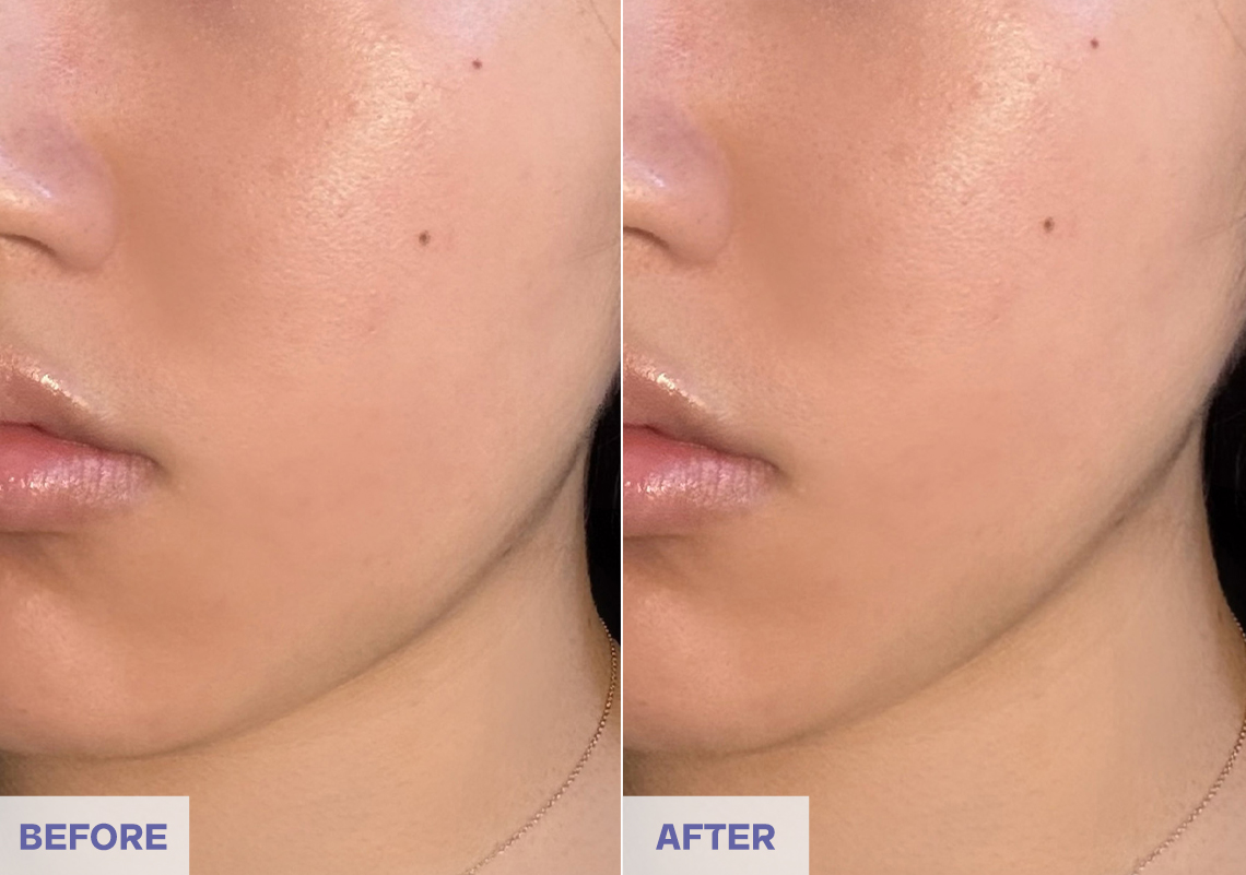 Before After 3 weeks