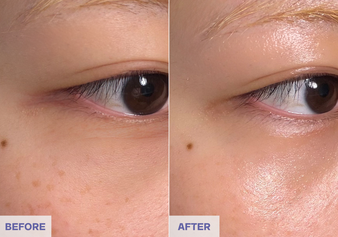 Before After 6 weeks