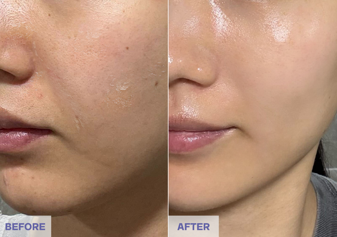 Before After 2 weeks