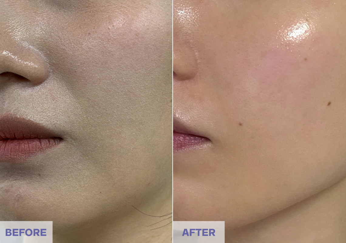 Before After 3 weeks