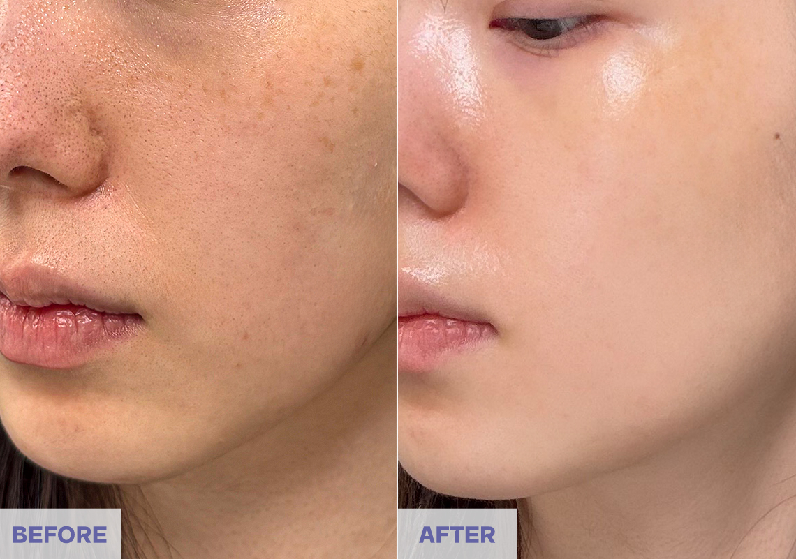 Before After 6 weeks