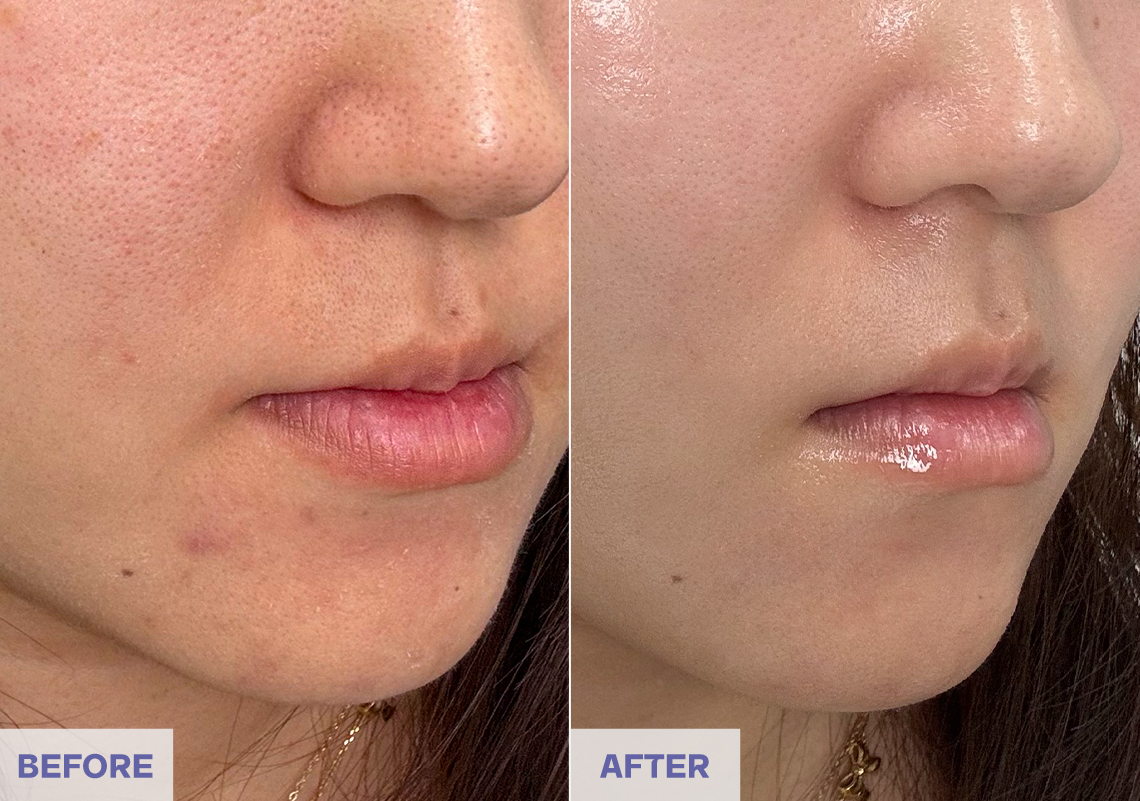 Before After 3 weeks