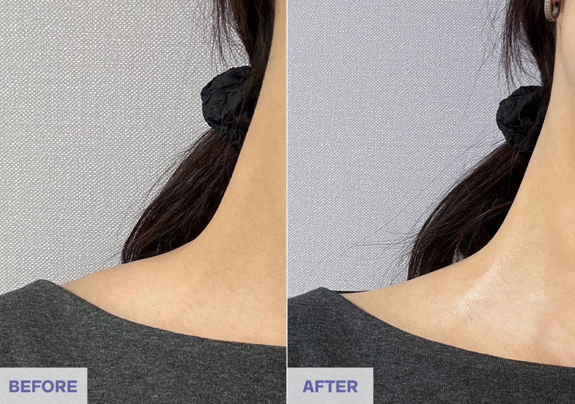 Before After 2 weeks