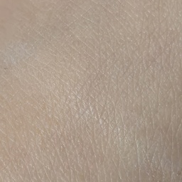 name