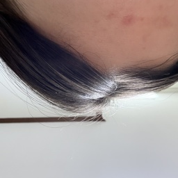 name
